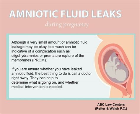 does leaking amniotic fluid smell|Leaking Amniotic Fluid: Signs, Causes, and。